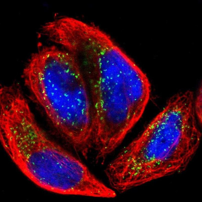 ACBD5 Antibody in Immunocytochemistry (ICC/IF)