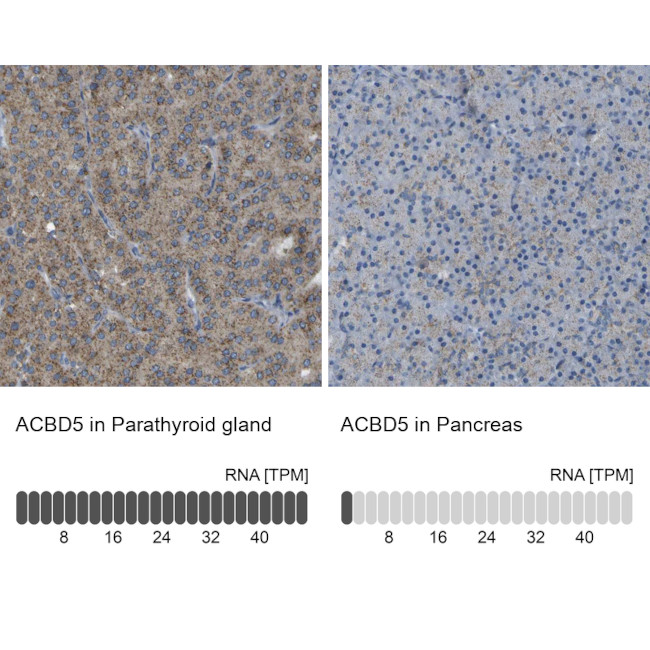 ACBD5 Antibody in Immunohistochemistry (IHC)