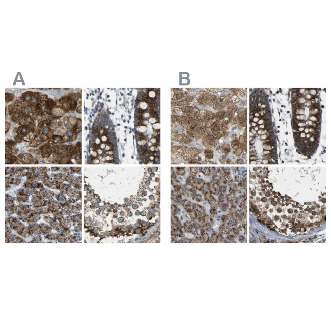 ACBD5 Antibody in Immunohistochemistry (IHC)