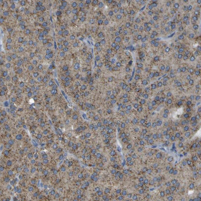 ACBD5 Antibody in Immunohistochemistry (IHC)