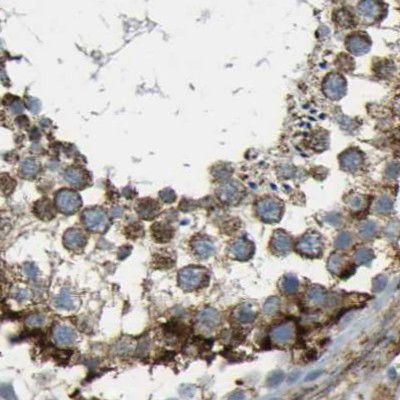 ACBD5 Antibody in Immunohistochemistry (IHC)