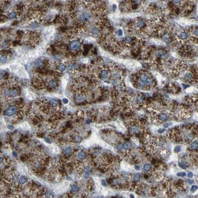 ACBD5 Antibody in Immunohistochemistry (IHC)