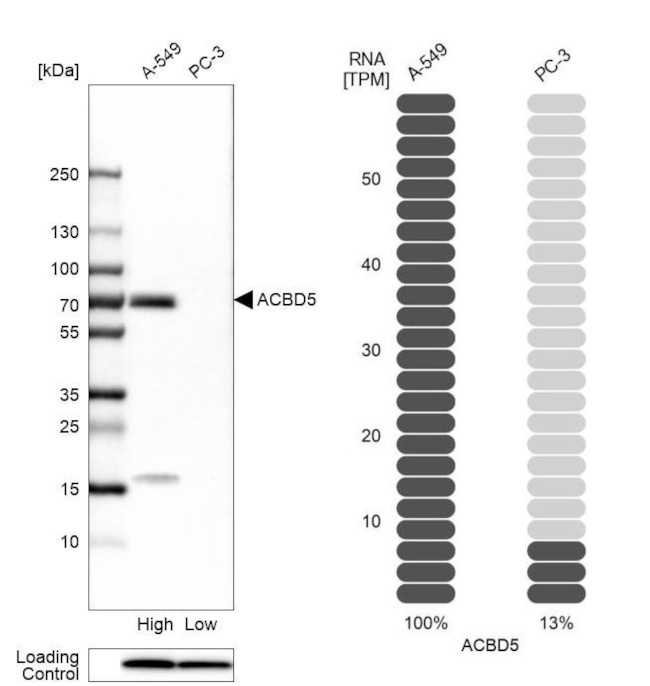 ACBD5 Antibody