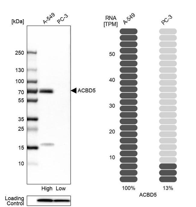 ACBD5 Antibody in Western Blot (WB)