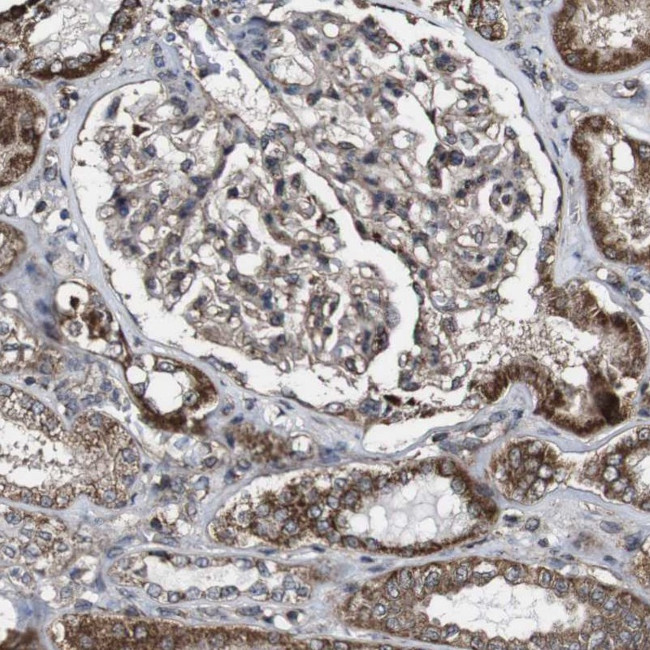 BTN3A3 Antibody in Immunohistochemistry (IHC)