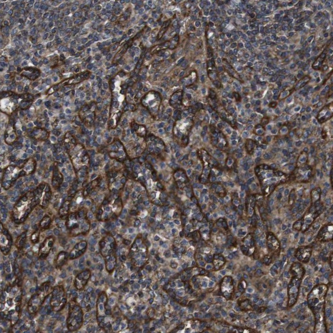 BTN3A3 Antibody in Immunohistochemistry (IHC)