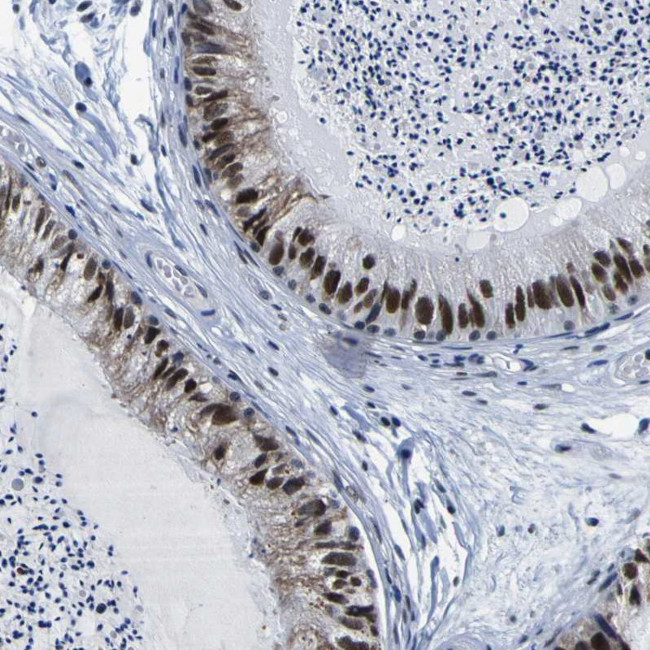 Cullin 4B Antibody in Immunohistochemistry (IHC)