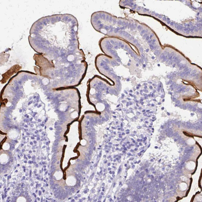 SI Antibody in Immunohistochemistry (IHC)