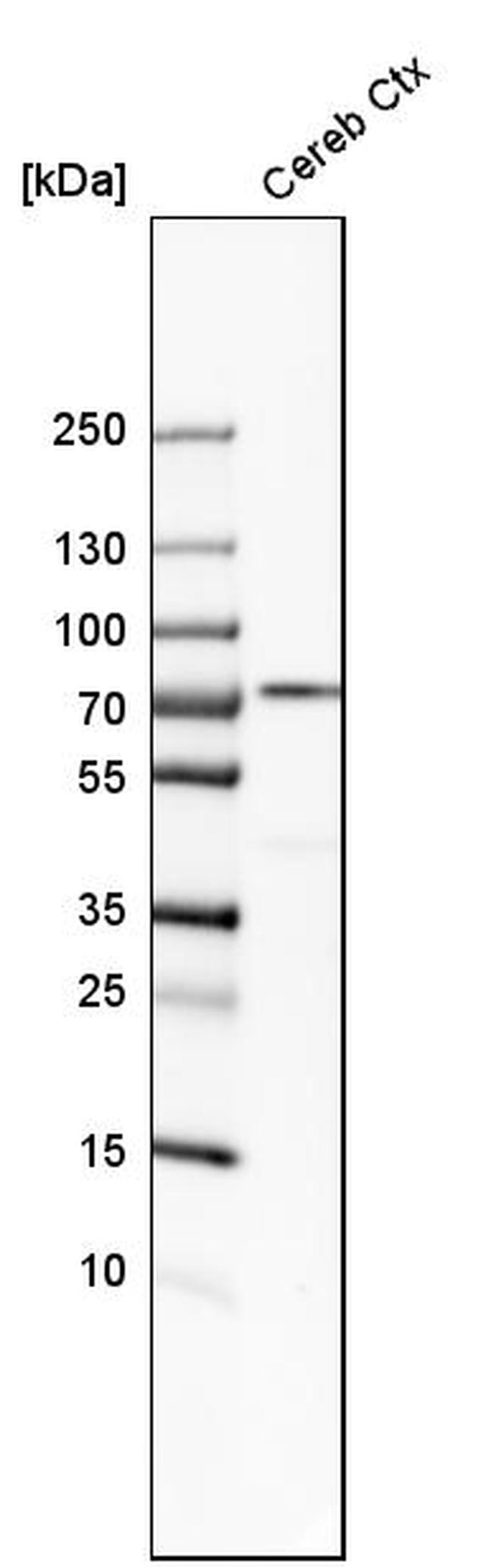 IGSF8 Antibody in Western Blot (WB)