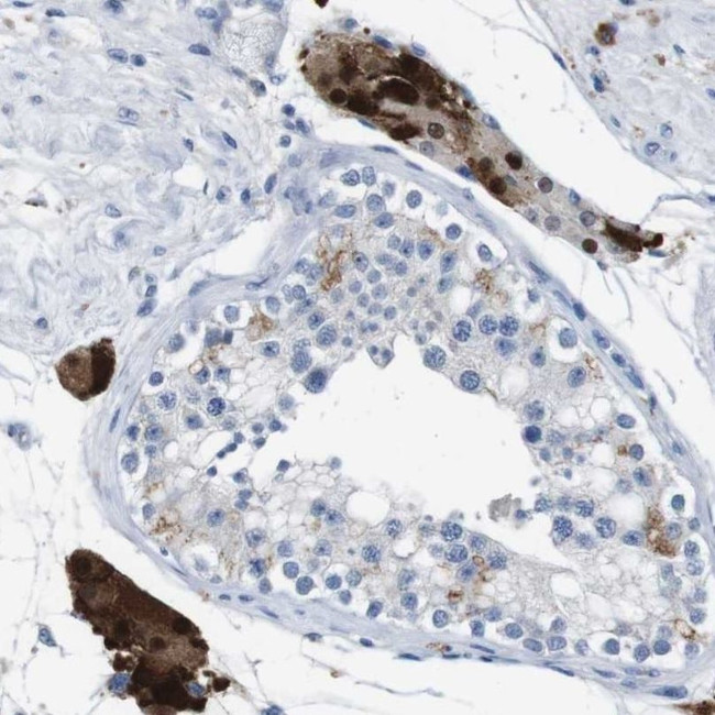 SLC2A8 Antibody in Immunohistochemistry (IHC)