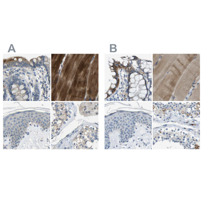 STBD1 Antibody in Immunohistochemistry (IHC)