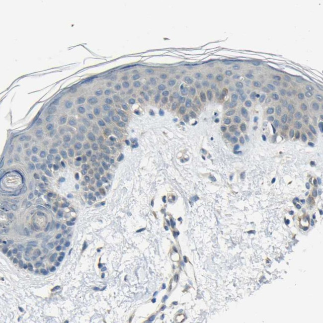 STBD1 Antibody in Immunohistochemistry (IHC)