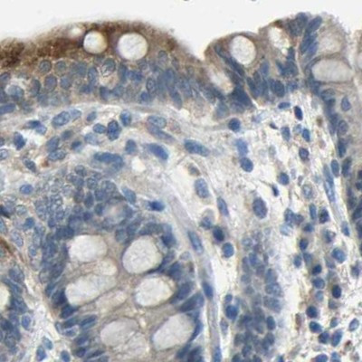 STBD1 Antibody in Immunohistochemistry (IHC)