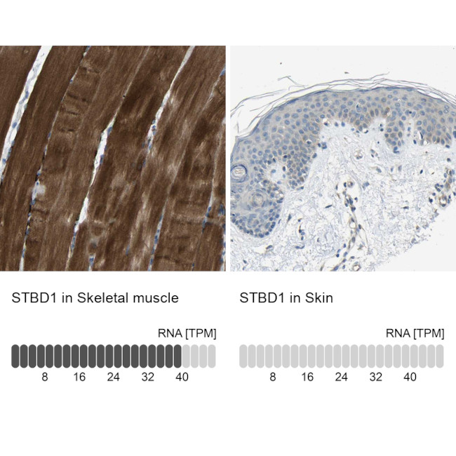 STBD1 Antibody