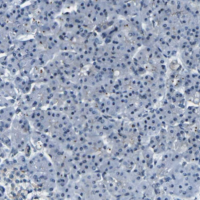 PARN Antibody in Immunohistochemistry (IHC)