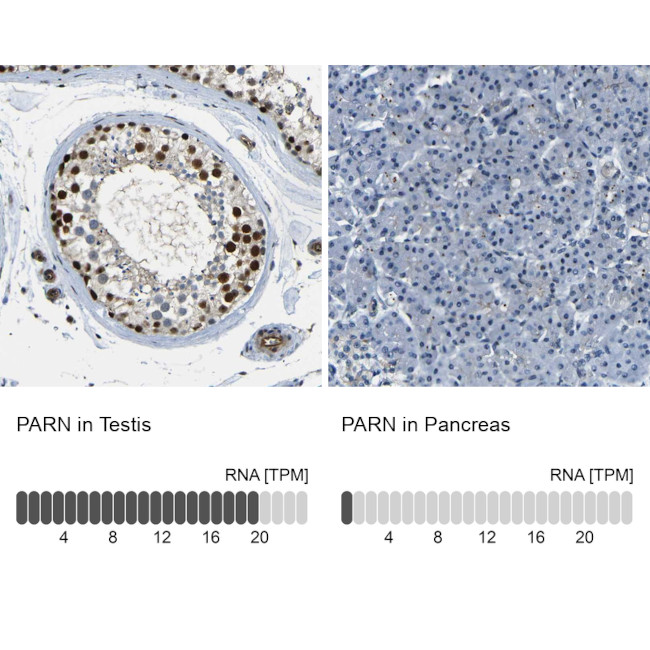 PARN Antibody