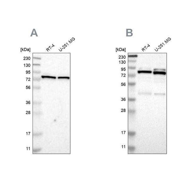 PARN Antibody in Western Blot (WB)