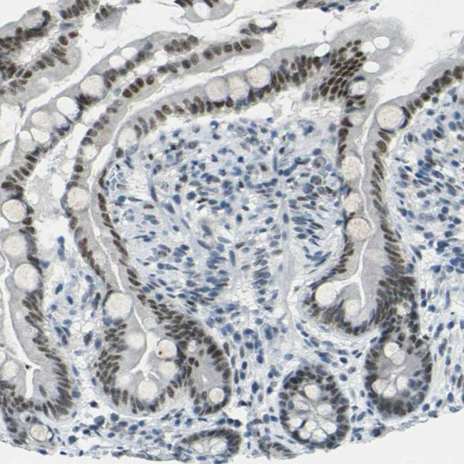 C/EBP gamma Antibody in Immunohistochemistry (IHC)