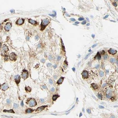 OXCT1 Antibody in Immunohistochemistry (IHC)