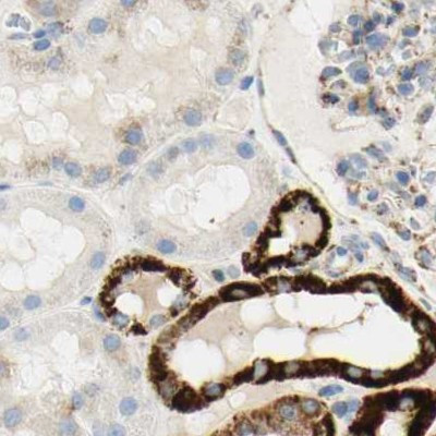 OXCT1 Antibody in Immunohistochemistry (IHC)