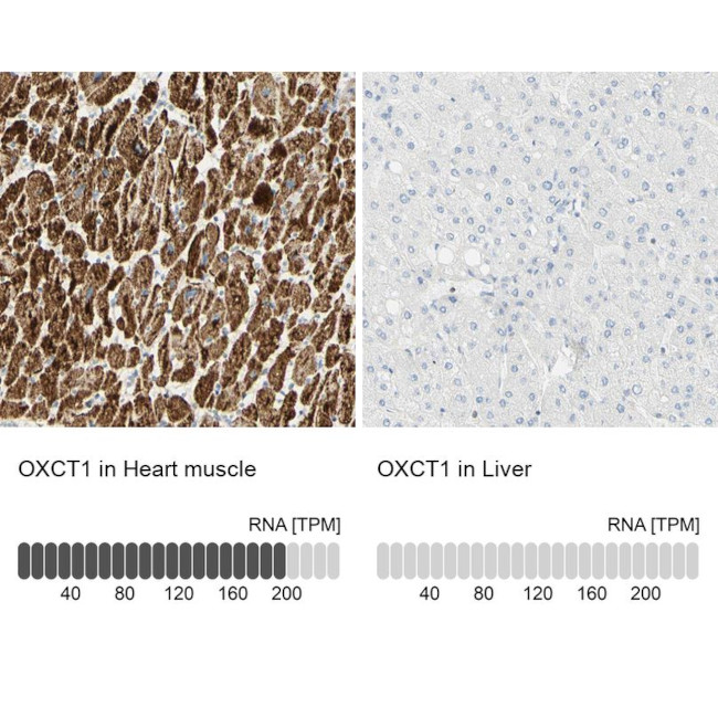 OXCT1 Antibody