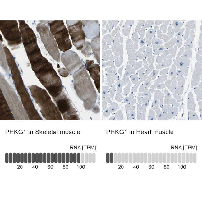 PHKG1 Antibody in Immunohistochemistry (IHC)