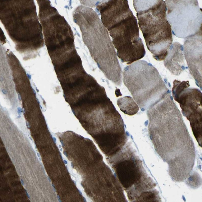 PHKG1 Antibody in Immunohistochemistry (IHC)