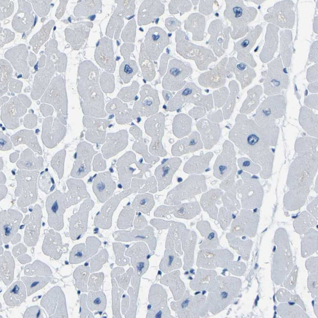 PHKG1 Antibody in Immunohistochemistry (IHC)