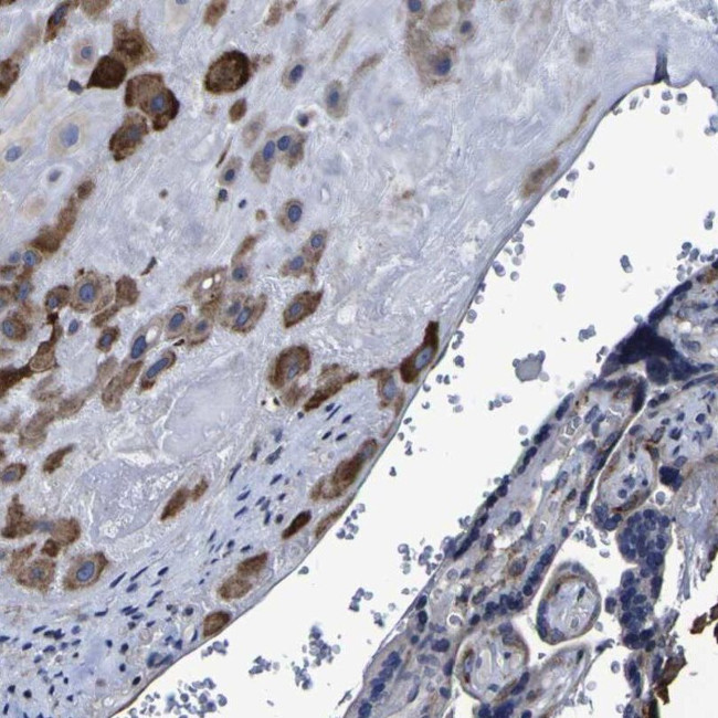 LEPRE1 Antibody in Immunohistochemistry (IHC)