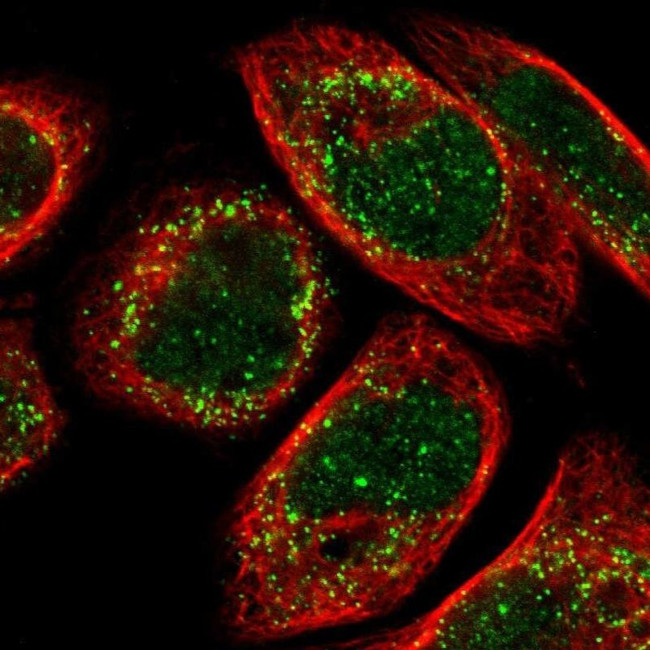 ACBD5 Antibody in Immunocytochemistry (ICC/IF)