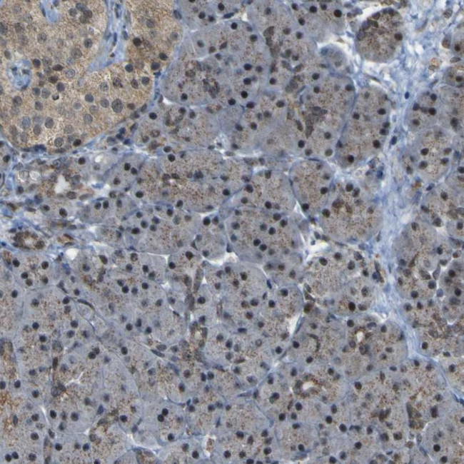 ACBD5 Antibody in Immunohistochemistry (IHC)