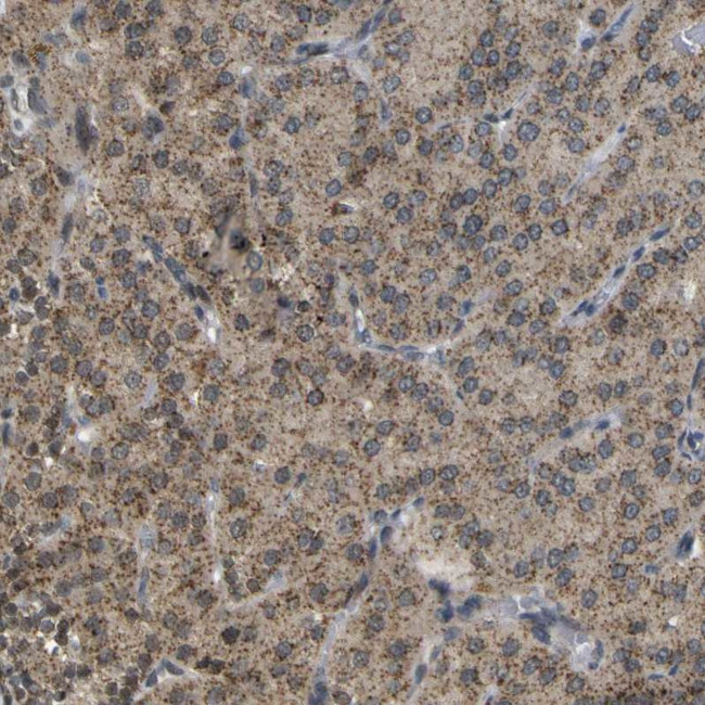 ACBD5 Antibody in Immunohistochemistry (IHC)