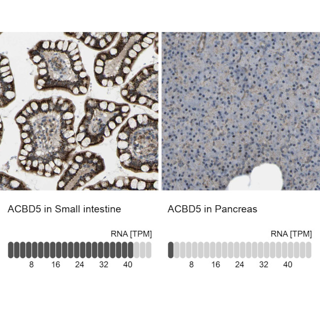 ACBD5 Antibody