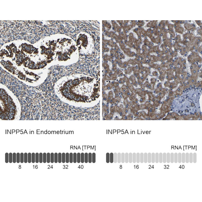 INPP5A Antibody in Immunohistochemistry (IHC)