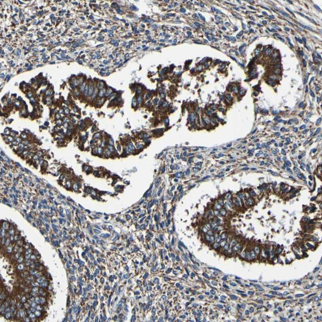 INPP5A Antibody in Immunohistochemistry (IHC)