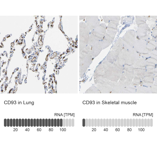 CD93 Antibody in Immunohistochemistry (IHC)