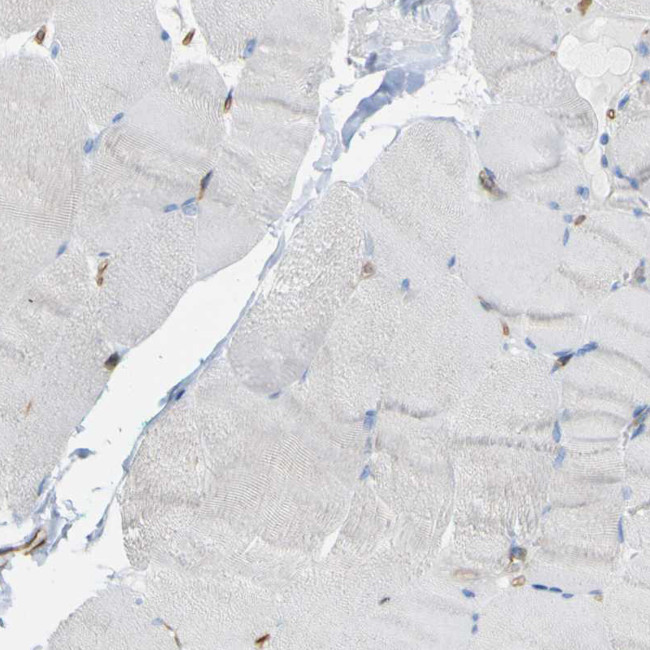 CD93 Antibody in Immunohistochemistry (IHC)