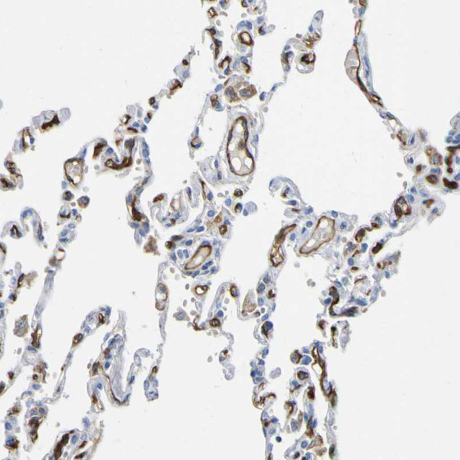 CD93 Antibody in Immunohistochemistry (IHC)