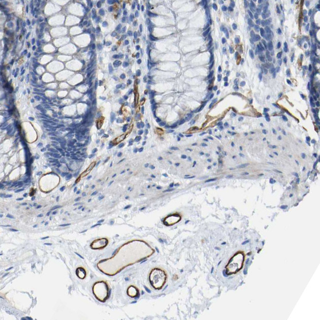 CD93 Antibody in Immunohistochemistry (IHC)