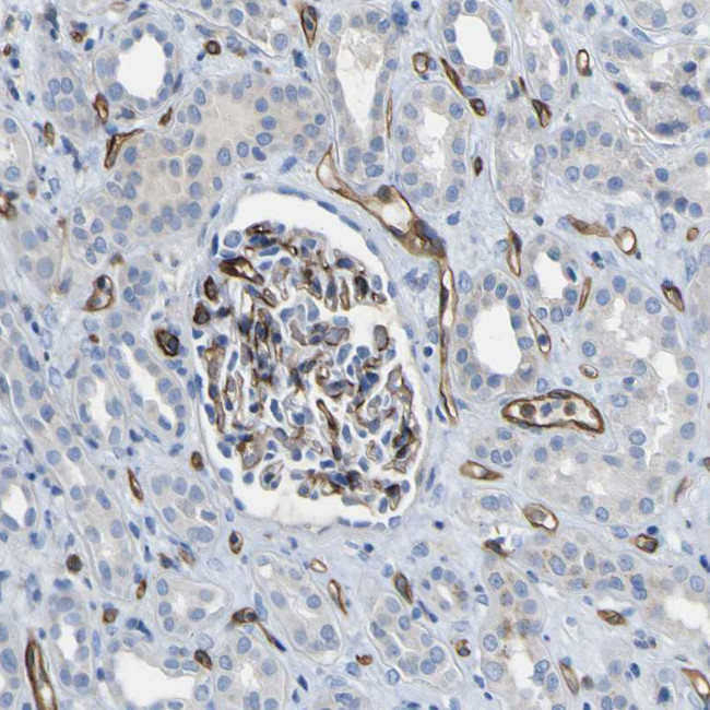 CD93 Antibody in Immunohistochemistry (IHC)