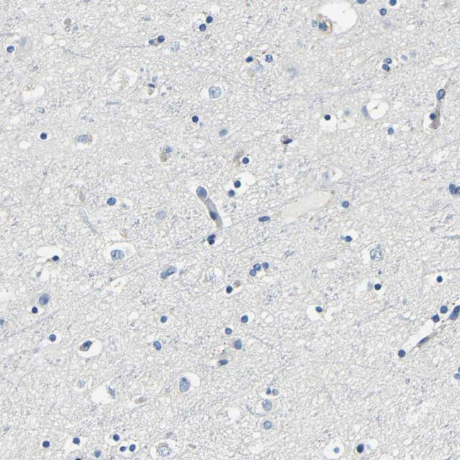 FMO5 Antibody in Immunohistochemistry (IHC)