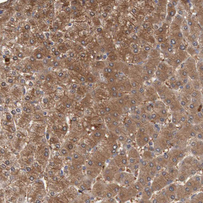 FBP1/FBP2 Antibody in Immunohistochemistry (IHC)