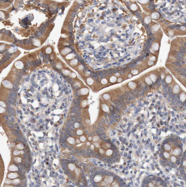 FBP1/FBP2 Antibody in Immunohistochemistry (IHC)