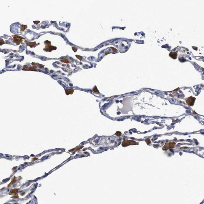 FBP1/FBP2 Antibody in Immunohistochemistry (IHC)