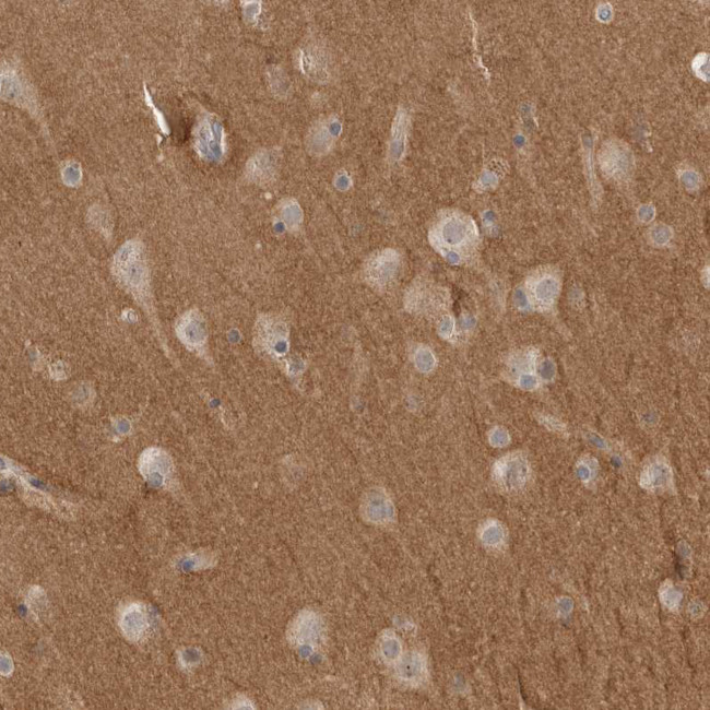 NRCAM Antibody in Immunohistochemistry (IHC)