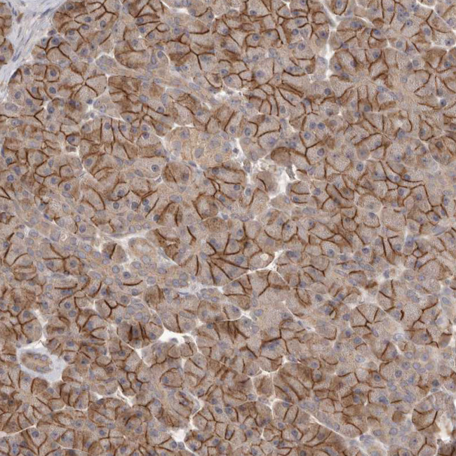 NRCAM Antibody in Immunohistochemistry (IHC)