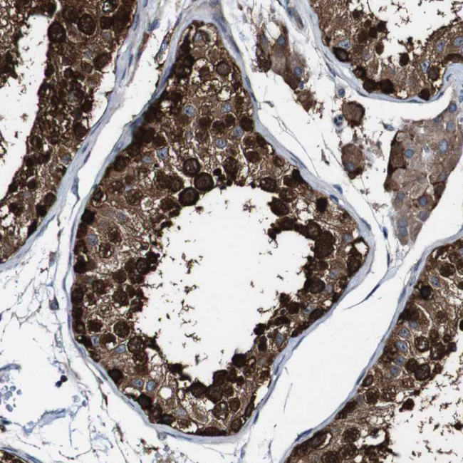 GALNT8 Antibody in Immunohistochemistry (IHC)