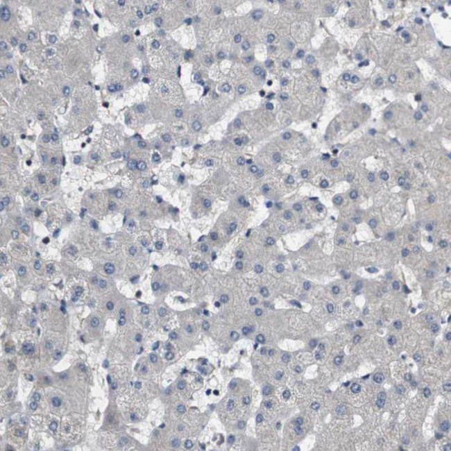 GALNT8 Antibody in Immunohistochemistry (IHC)