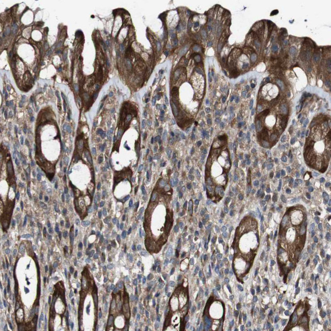 GALNT8 Antibody in Immunohistochemistry (IHC)