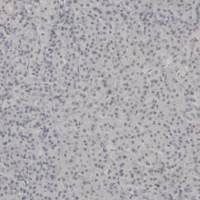 PLA2R1 Antibody in Immunohistochemistry (IHC)